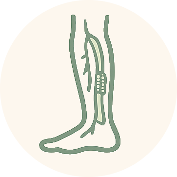 Peripheral Artery Disease